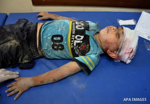 A Palestinian boy, wounded in an Israeli air strike on the al-Shati refugee camp, lies on a stretcher as he is treated at the al-Shefa hospital in Gaza City, on August 4, 2014. An eight-year-old girl was killed and 30 pe...