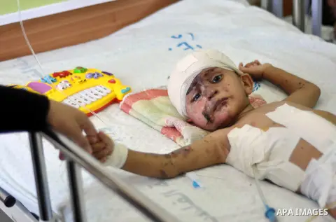 A Palestinian boy, who medics said was injured during the Israeli military offensive on Gaza Strip, lies on a bed at al-Shifa hospital in Gaza City on August 06, 2014. The ceasefire, which came into effect on August 5, h...