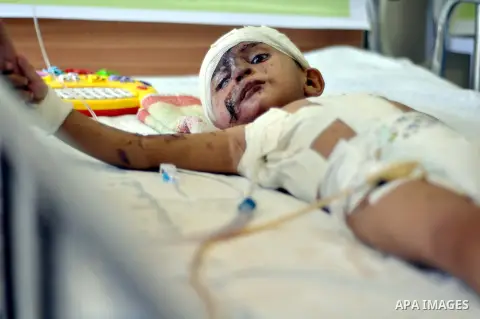 A Palestinian boy, who medics said was injured during the Israeli military offensive on Gaza Strip, lies on a bed at al-Shifa hospital in Gaza City on August 06, 2014. The ceasefire, which came into effect on August 5, h...