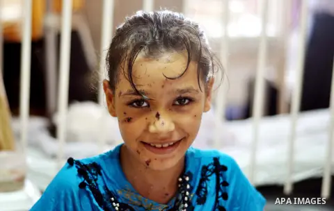 A Palestinian girl, who medics said was injured during the Israeli military offensive on Gaza Strip, poses for a picture at al-Shifa hospital in Gaza City on August 06, 2014. The ceasefire, which came into effect on Augu...