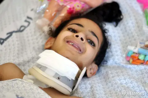 A Palestinian girl, who medics said was injured during the Israeli military offensive on Gaza Strip, poses for a picture as she lies on a bed at al-Shifa hospital in Gaza City on August 06, 2014. The ceasefire, which cam...
