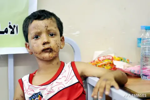 A Palestinian boy, who medics said was injured during the Israeli military offensive on Gaza Strip, poses for a picture at al-Shifa hospital in Gaza City on August 06, 2014. The ceasefire, which came into effect on Augus...