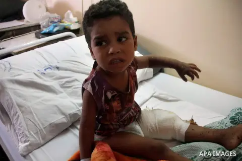 A Palestinian boy, who medics said was wounded during the Israeli offensive, lies on a bed at the Red Crescent hospital, Cairo, Egypt on August 15, 2014. Two successive truces since Monday, expected to last through Augus...