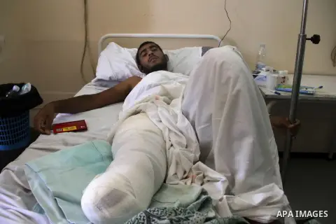 A Palestinian man, who medics said was wounded during the Israeli offensive, lies on a bed at the Red Crescent hospital, Cairo, Egypt on August 15, 2014. Two successive truces since Monday, expected to last through Augus...