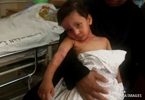 Omar Ali Wahdan, a three-year-and-a-half-old Palestinian boy wounded in the latest Israeli assault on the Gaza Strip, lies on his hospital bed as he receives treatment for burns and injuries at the al-Shefa hospital in G...