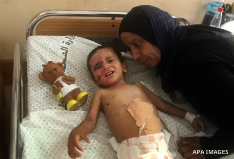 Mohammed Ali Wahdan, a two-year-old Palestinian boy wounded in the latest Israeli assault on the Gaza Strip, lies on his hospital bed as he receives treatment for burns and injuries at the al-Shifa hospital in Gaza City,...