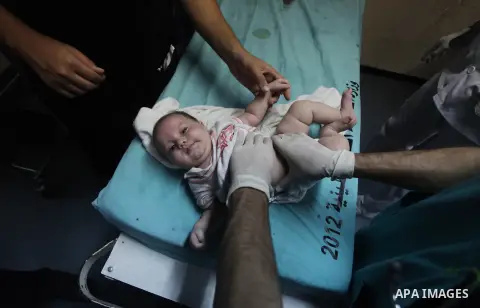 Palestinian doctors care for wounded baby at the hospital following an Israeli air strike on a house in Gaza City on August 19, 2014. The Israeli air strike killed a young girl and a woman, wounding 16 other people. Isra...