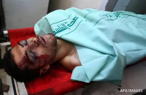 The body of Palestinian Abdallah Ghanayem, 22, lies on a bed at a hospital in the West Bank city of Ramallah, on June 14, 2015. Palestinian sources said that Ghanayem had been shot in the lower back during clashes in the...