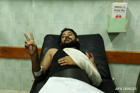 An injured Palestinian protester, who was wounded during clashes with Israeli security forces in the east of Gaza city, recieves treatment at al-Shifa hospital in Gaza city on October 16, 2015. The unrest that has engulf...