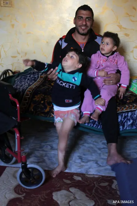 Palestinian Wael al-Namla and his son Sharif, who were both injured during the 50-day war between Israel and Hamas militants in the summer of 2014, sit in on the bed at their house on Feb. 28, 2016 in Rafah in the southe...