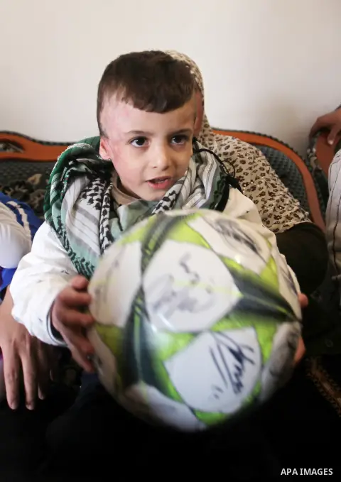Palestinian boy Ahmed Dawabsha, 5, who suffered severe burns in an arson attack by suspected Jewish attackers on his family home last July and in which his younger brother, Ali, and his parents both died, is welcomed by...