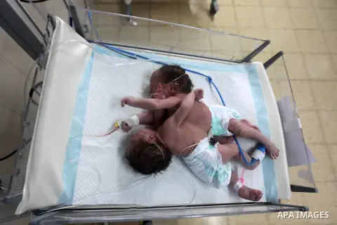 One-day-old Palestinian conjoined twin boys lie in an incubator at the nursery Hospital in the West Bank city of Hebron, March 16, 2017. Photo by Wisam Hashlamoun