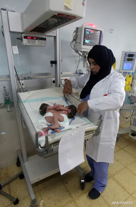 A Palestinian nurse checks on a One-day-old Palestinian conjoined twin boys lie in an incubator at the nursery Hospital in the West Bank city of Hebron, March 16, 2017. Photo by Wisam Hashlamoun