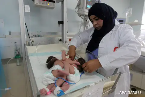 A Palestinian nurse checks on a One-day-old Palestinian conjoined twin boys lie in an incubator at the nursery Hospital in the West Bank city of Hebron, March 16, 2017. Photo by Wisam Hashlamoun