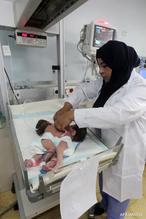A Palestinian nurse checks on a One-day-old Palestinian conjoined twin boys lie in an incubator at the nursery Hospital in the West Bank city of Hebron, March 16, 2017. Photo by Wisam Hashlamoun