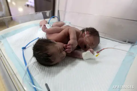 One-day-old Palestinian conjoined twin boys lie in an incubator at the nursery Hospital in the West Bank city of Hebron, March 16, 2017. Photo by Wisam Hashlamoun