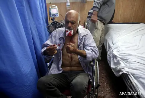 Palestinian man Tayseer Hassan Suleiman, 62, sits in a wheelchair while he receiving treatment after Israeli settlers attacked him as he works in his land at the Rafidia hospital in the West Bank city of Nablus, on March...