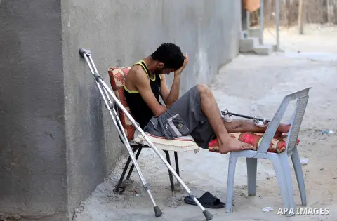 A Palestinian youth Mahmoud Darwish, 17, who was wounded in the leg during clashes with Israeli security forces at the Gaza-Israeli border, sits outside his home, in al-Nusairat refugee camp in the central Gaza Strip on...