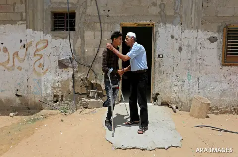 Palestinian Mohammed Musabeh, 17, a High school student, who amputated his leg after he was shot by Israeli troops during clashes in tents protest demanding the right to return to their homeland, at the Israel-Gaza borde...