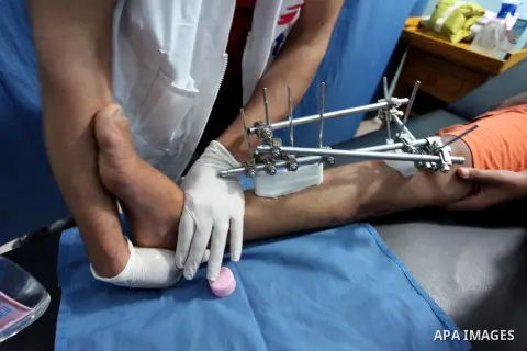 A Palestinian wounded who was injured during clashes with Israeli troops in tents protest where Palestinians demand their rights to return to their homeland at Israel-Gaza border, receives treatment at Doctors Without Bo...