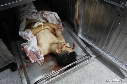 The body of Palestinian Amir Al-Namara, who was killed in an Israeli air strike, is seen at morgue in al-shifa hospital, in Gaza city on July 15, 2018. Photo by Mahmoud Ajour