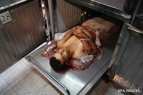 The body of Palestinian Louay Kahil, who was killed in an Israeli air strike, is seen at morgue in al-shifa hospital, in Gaza city on July 15, 2018. Photo by Mahmoud Ajour