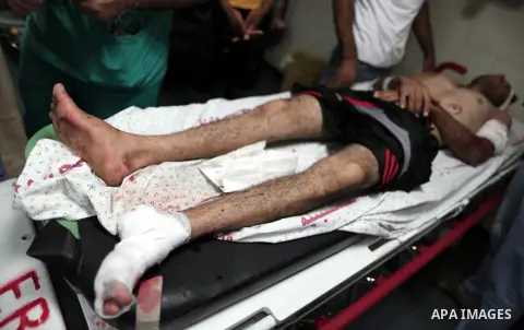 A Palestinian man who was wounded by Israeli troops during clashes at the Israel-Gaza border, in a tent city protest where Palestinians demand the right to return to their homeland, receives treatment at al-Shifa hospita...