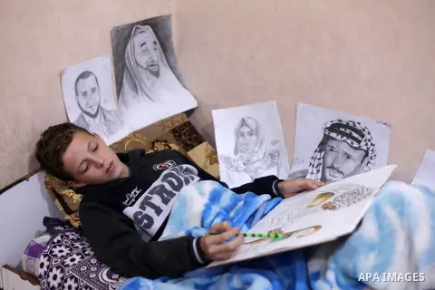 A Palestinian painter Majd al-Madhoun, 13, who was wounded by Israeli army in the head on November 19, during a demonstration against the Israeli blockade on Gaza Strip, along the Gaza sea barrier on the maritime border...