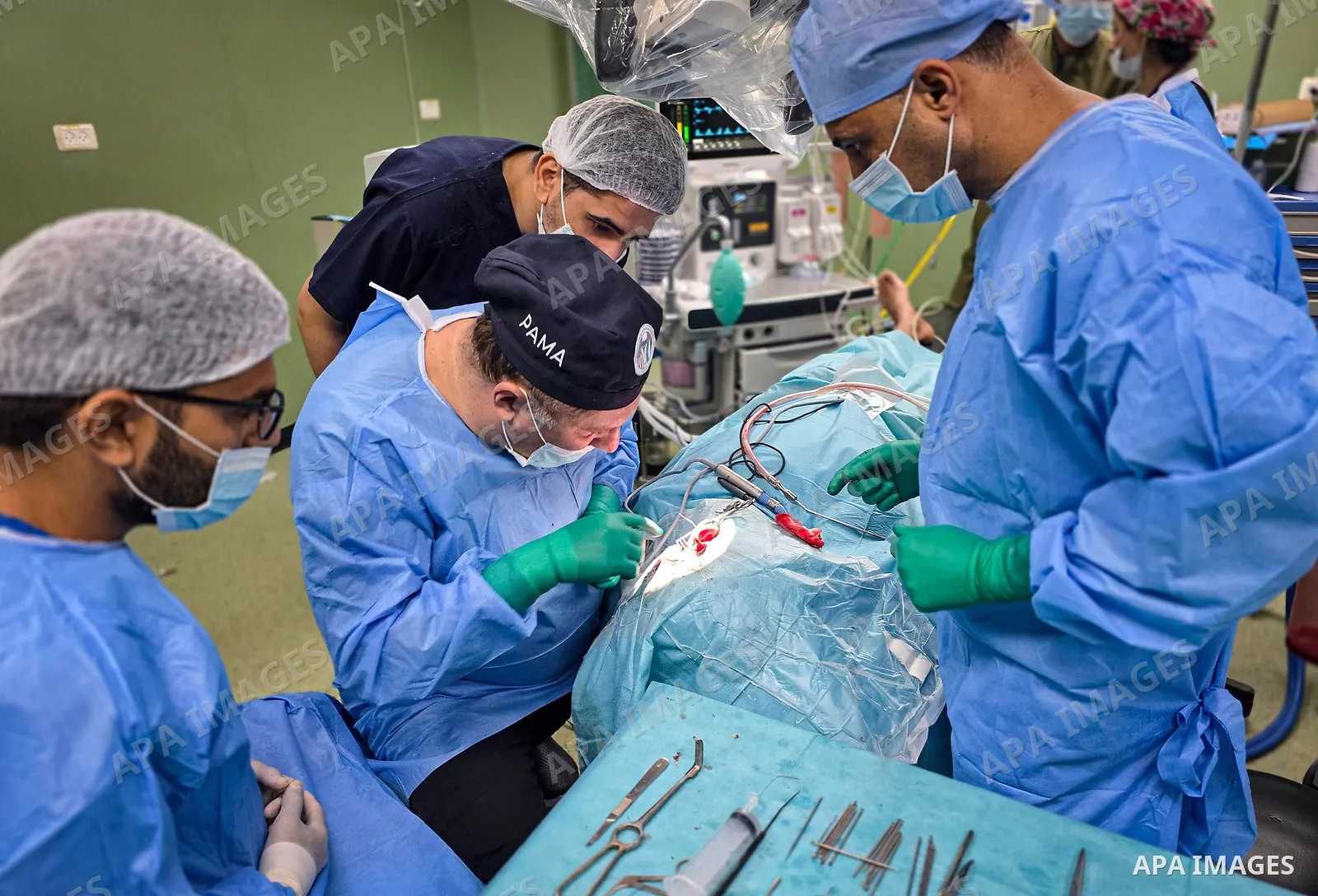 A medical team performs cochlear implant surgery on a child at Nasser Medical Complex in Khan Younis, southern Gaza Strip, on September 27, 2026. The operation is part of a project to provide similar surgeries for 50 chi...